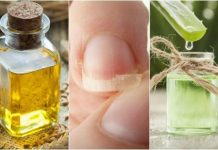 How To Treat Broken Nails With These 5 Natural Remedies