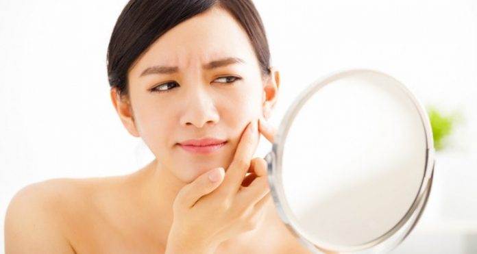 7 Habits of Everyday Life to Avoid Acne