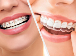 tauntonorthodontics-why-orthodontic-treatment-is-important