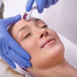 7 Benefits of Getting a Microneedling Treatment