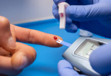 Type 2 Diabetes